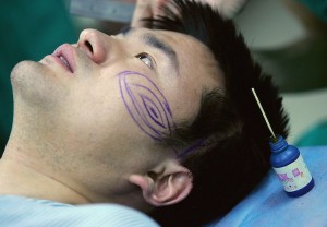 Popularity of Cosmetic Surgery on the Rise